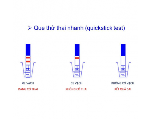 Que thử thai QUICKSTICK Mỹ