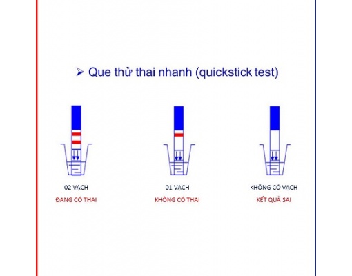 Que thử thai QUICKSTICK Mỹ
